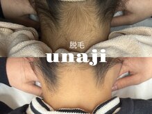 ラティエ(Latier)/美うなじ脱毛/印象UP↑