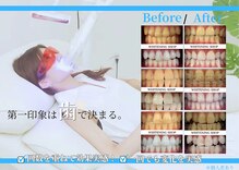 ホワイトニングショップ 春日井店(whitening shop)