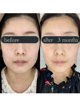 ダブリュー アイプラス 明石店(W eye+)/