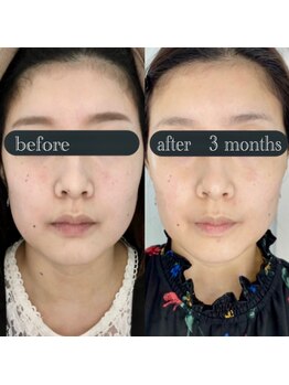 ダブリュー アイプラス 明石店(W eye+)/