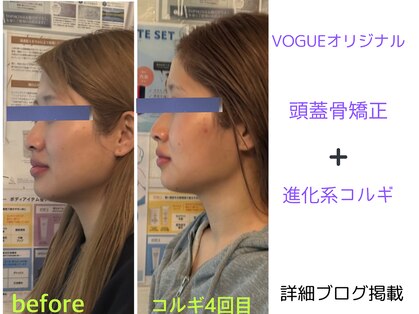 ヴォーグ(VOGUE)の写真