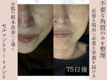 シェリートーキョー 成田店(Cherie Tokyo)