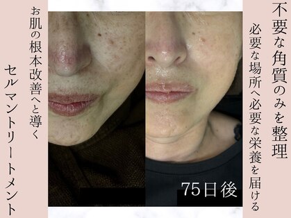 シェリートーキョー 成田店(Cherie Tokyo)の写真