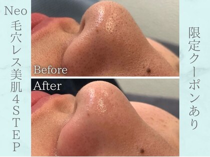 ネオファースト(NeoFirst)の写真