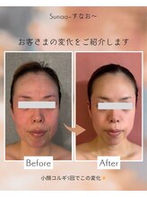 すなお 溝の口(Sunao)/【小顔コルギ】40代お客様