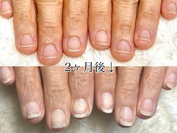 グレースレディ 大阪店/(深爪/長さだし/フィルイン)