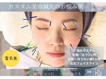 ミエリア美容鍼灸院(mielia美容鍼灸院)/★カスタム美容鍼灸の特徴
