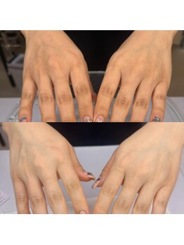 アトラ 池袋(Atula)の写真/【池袋駅近】白を基調とし清潔感あるサロン◎通いやすい価格帯&高い技術力◎リーズナブルなクーポン多数♪
