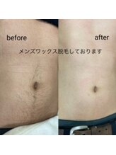 ヘアファッション ユミ(HAIR FASHION YUMI)/メンズ胸周りからへそ下