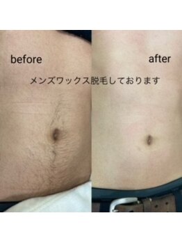 ヘアファッション ユミ(HAIR FASHION YUMI)/メンズ胸周りからへそ下