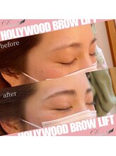 ディアレスト(Dearest)/HOLLYWOOD BROW LIFT