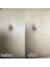 ルナソル 昭島店(LUNASOL)/メンズワックス脱毛