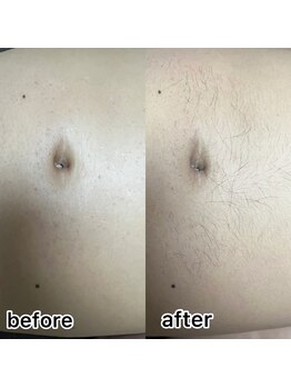 ルナソル 昭島店(LUNASOL)/メンズワックス脱毛