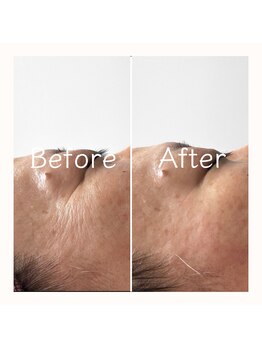 エービューティ(A.beauty)/30代～のエイジングケア