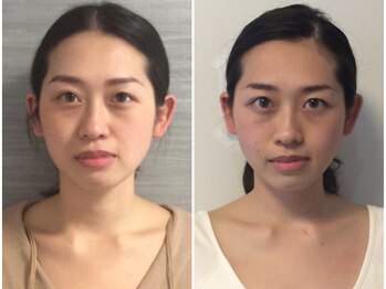 美容整体ウェリナ あま甚目寺院/小顔矯正/骨盤矯正/美脚サロン