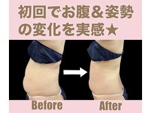 スワン 新栄店(SWAN)/ぽっこりお腹に特化している痩身