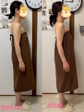 ルアナ(LUANA)/庄野式ビフォーアフター♪