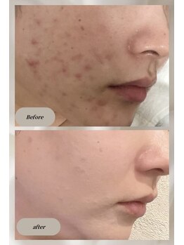 リノ 西宮北口店(Lino)/