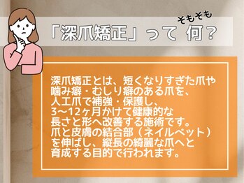 レアム/「深爪矯正」とは？