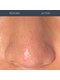 ビナリ 東銀座(BINARI)の写真/毛穴汚れやくすみを徹底ケア。眉毛スタイリングやホワイトニングもあわせて第一印象を一気に整える☆