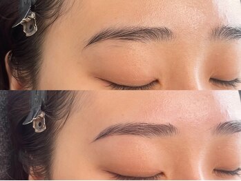 シス(sis)/困り眉解消