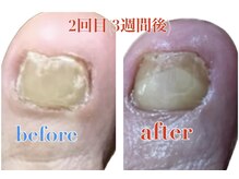 ウォーク(Walk)の雰囲気（爪の悩みをお持ちの方サンダルを履けるようになりたい方は当店へ）