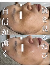 セリー(Celie)/お客様症例