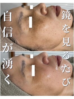 セリー(Celie)/お客様症例