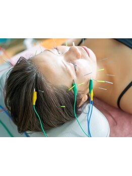 小顔になりたい