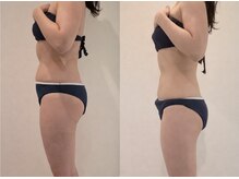 アンベリール(Embellir)/徹底的に脂肪燃焼