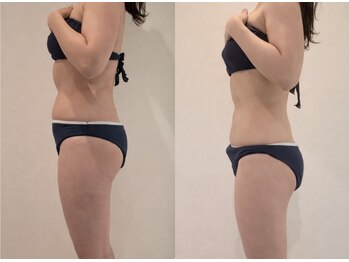 アンベリール(Embellir)/徹底的に脂肪燃焼