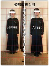 リバイブ 自由が丘店(REVIVE)/姿勢改善1回