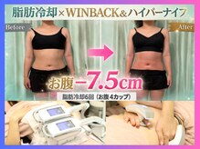 ボディーリセット 勝どきの雰囲気（スタッフ２名で施術するから短時間でも効果が違う！と好評♪）