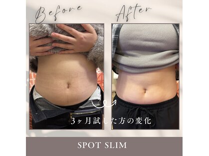 スポットスリム(SPOT SLIM)の写真
