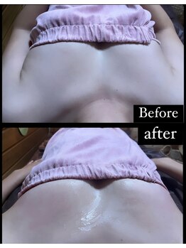 フェアリー/バスト デコルテケア