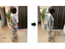 ツリーオブボディケア(TREE OF BODY CARE)/立ち姿勢　ビフォーアフター