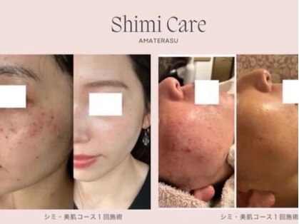 ココ(KOKO)の写真
