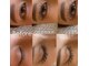 グロウ アイラッシュ(grow eyelash)の写真