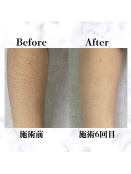 イルマーレ(Il Mare)/お客様Before&After