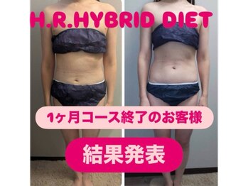 ビジュー(Bijou)の写真/【2ヶ月でマイナス10キロ減の方も◎】我慢しない！ダイエット。美しく痩せれるダイエットコース！