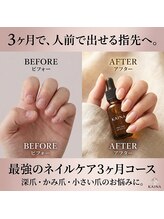 ラウレア(laule'a)&nbsp;森 唯我