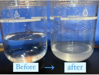 フェアリー/ハイドラフェイシャル 毛穴洗浄