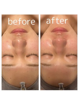 ピュアスキンサロン 恵比寿店(pure skin salon)/韓国肌管理【恵比寿代官山】
