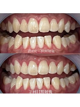 レヴィオ(Revio_)/ナチュラルホワイトニング