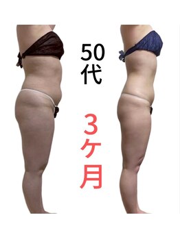 キレイ(KIREI)/衝撃のbefore/after　50代