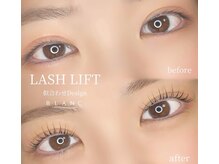 アイラッシュサロン ブラン せんちゅうパル千里中央店(Eyelash Salon Blanc)/【まつ毛パーマ】Before/After