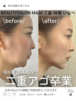 エムアンドエム(M&M)/