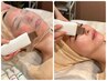 【しみ・美白ケア】美白陶器肌マシンコース90分