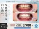 モンキーホワイトニング 西千葉の写真