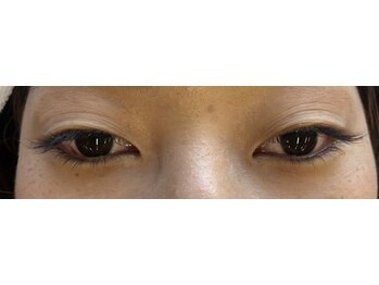 シルフ 松原店(Sylph)/Eye Beauty Salon Sylph 松原店